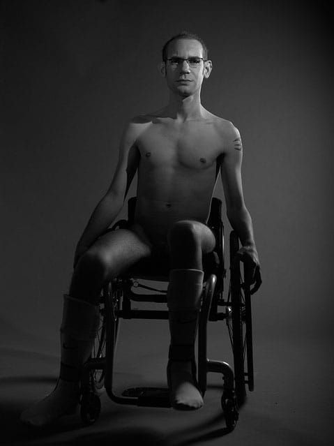 Robert Coombs, a photograph from the series "Disabilities and Sexuality"