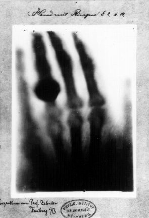 The first X-ray from 1895 by Wilhelm Röntgen of the hand of his wife Anna (via National Aeronautics and Space Administration)