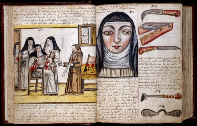 A nun being treated for a lachrimal fistula, from a book compiled for the use of a House of the Franciscan Order in Germany (1675)