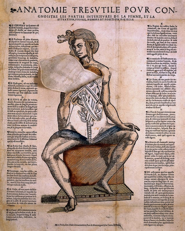 Hand-colored woodcut of female anatomy from Alain de Matonniere's 1650 "Anatomie tresutile pour congnoistre les parties interieures de la femme"