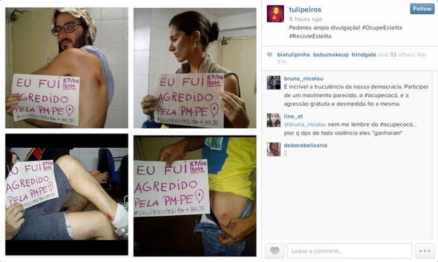 A composite of wounded protestor photos (via tulipeiros on Instagram)