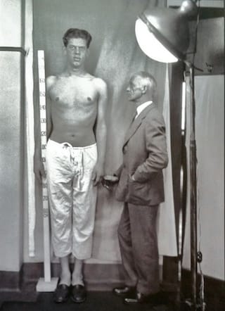 Harvey Cushing posing with a patient with acromegaly (Cushing Center, via Yale Journal of Biology and Medicine)