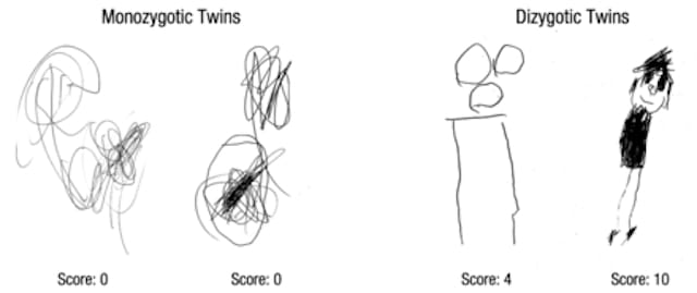 (image courtesy of King's College London) 