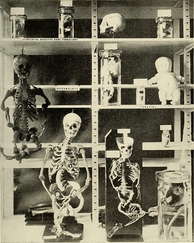 "Bulletin of the Warren Anatomical Museum" (1910) (via Internet Archive Book Images)