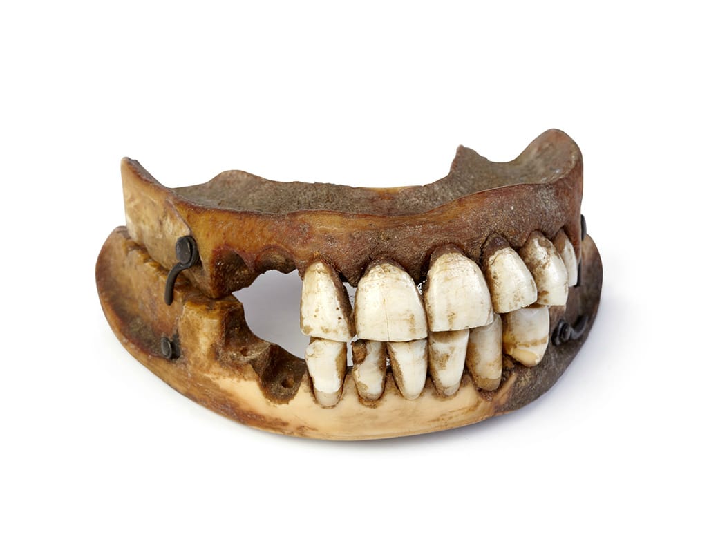 "Waterloo teeth" made with real human teeth from dead soldiers (courtesy Victoria Gallery & Museum, University of Liverpool. Photography Relic Imaging Ltd.)