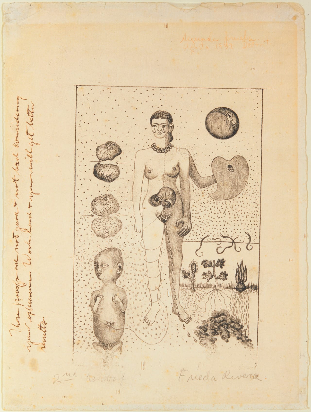 Frida Kahlo, "Frida and the Miscarriage" ("El Aborto") (1932), lithograph (© ARS, NY; Museo Dolores Olmedo Patiño; photo by Schalkwijk/Art Resource, NY)