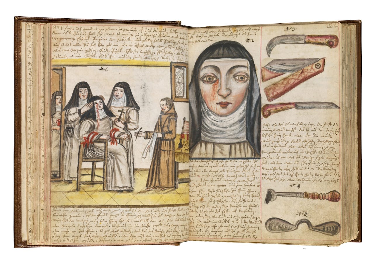 Credit: Wellcome Library, London. Wellcome Images