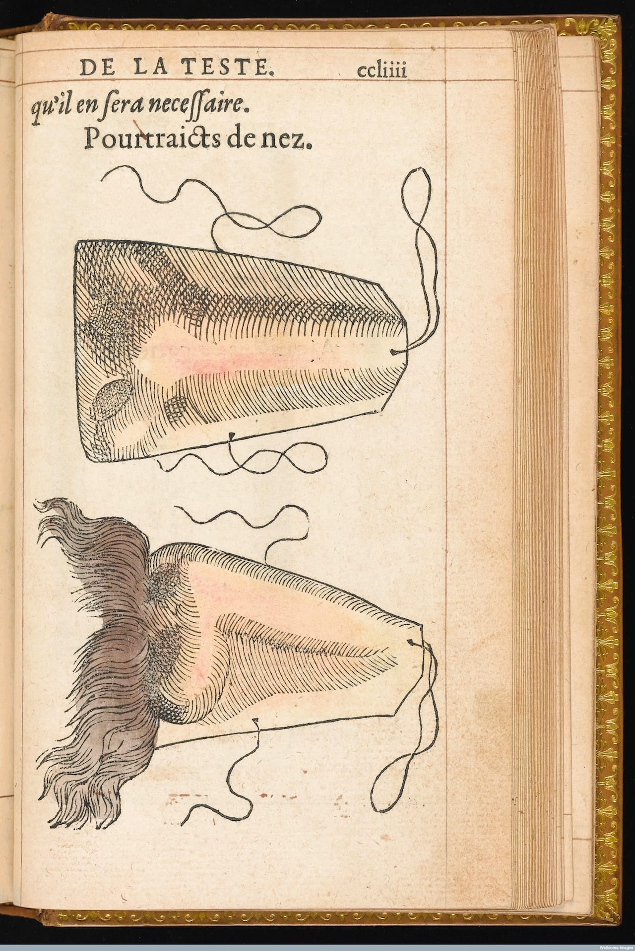 L0041126 Hand coloured illustration of a prosthetic nose. Credit: Wellcome Library, London. Wellcome Images images@wellcome.ac.uk http://wellcomeimages.org Hand coloured illustration of a prosthetic nose. 1561 By: Ambroise ParÈLa methode curative des playes, et fractures de la teste humaine. : Ambroise ParÈ Published: 1561. Copyrighted work available under Creative Commons Attribution only licence CC BY 4.0 http://creativecommons.org/licenses/by/4.0/