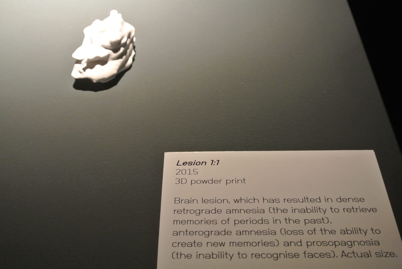 Shola Illingworth, Lesion 1-1 (2015), 3D powder print (click to enlarge)