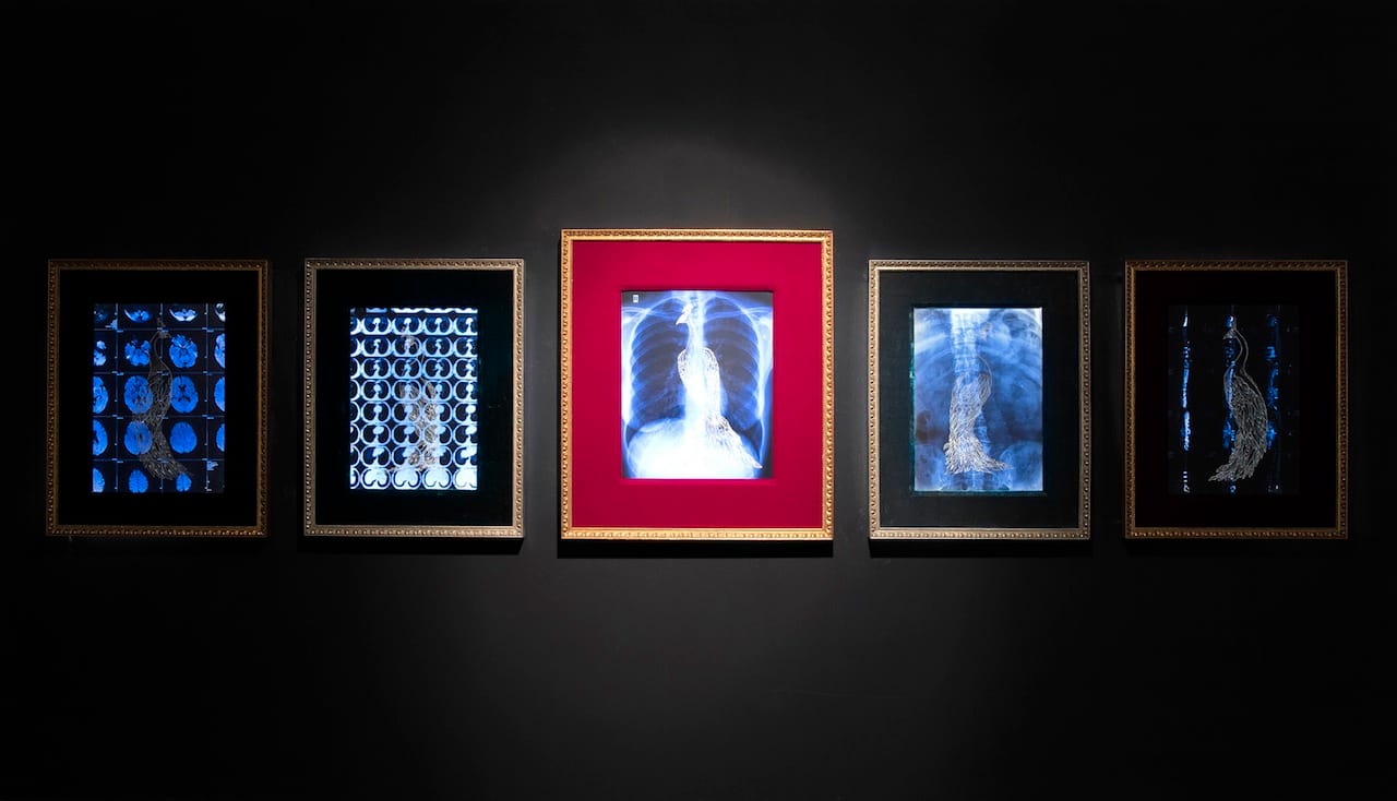Serra Behar, "Can you see us?" (2015), frame, drawing on x-ray, lightbox, 57x50cm (center), 51x41cm (others)
