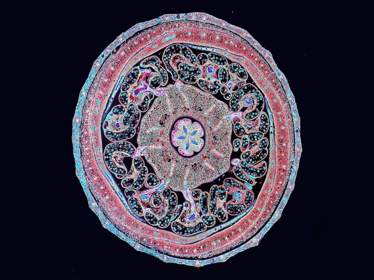 P 120 E Floral bud of a cotton plant