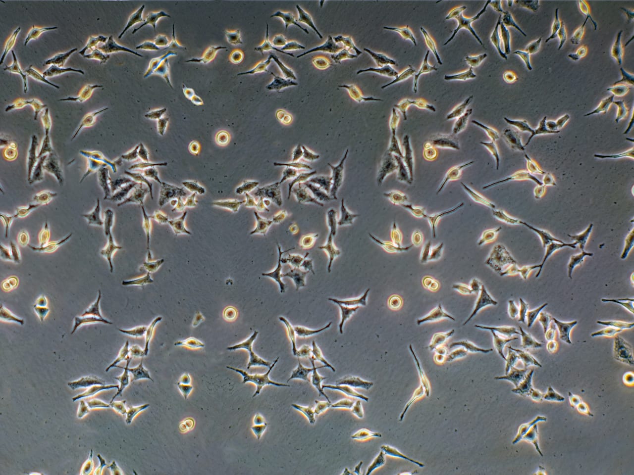 P 162 Phase contrast light micrograph of prostate cancer cells