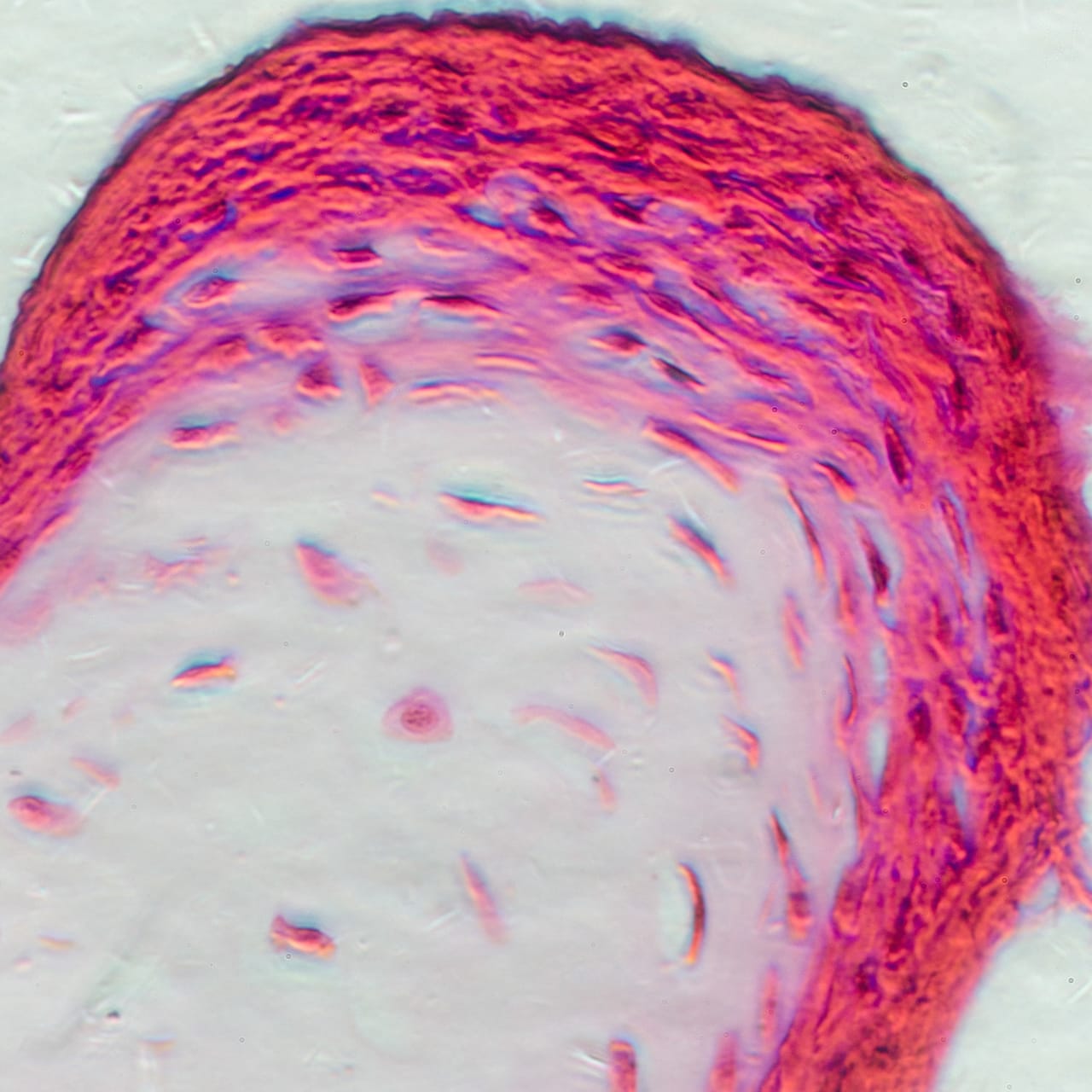 P 175 B Collagen stains in a light micrograph of osteocytes in bone