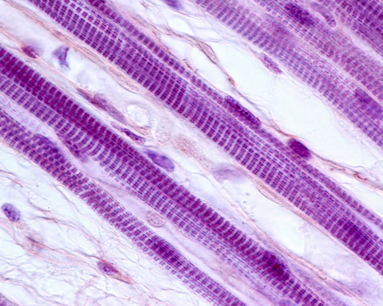 P 177 Micrograph of Striated Skeletal Muscle Fibers