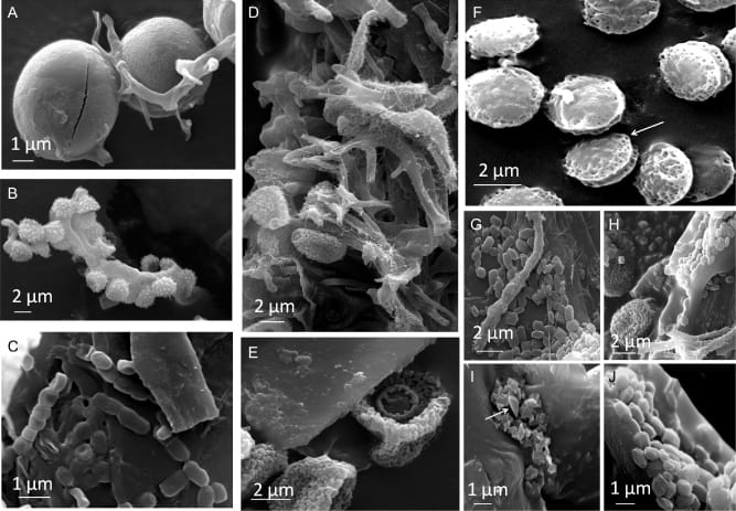 Scanning Electron Microscopy (SEM) imaging of fungal and bacterial structures on the drawing (courtesy University of Natural Resources and Life Sciences, Vienna)