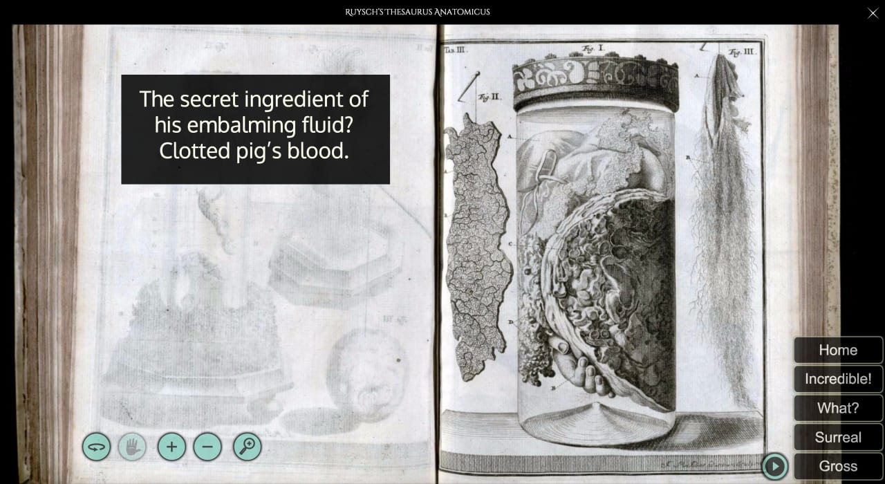 Frederik Ruysch's 'Thesaurus anatomicus primus' on Memento Mütter (screenshot by the author for Hyperallergic)