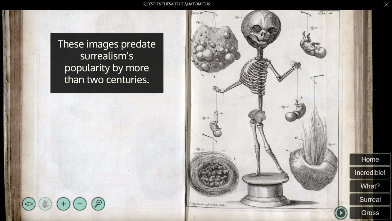 Frederik Ruysch's 'Thesaurus anatomicus primus' on Memento Mütter (screenshot by the author for Hyperallergic)
