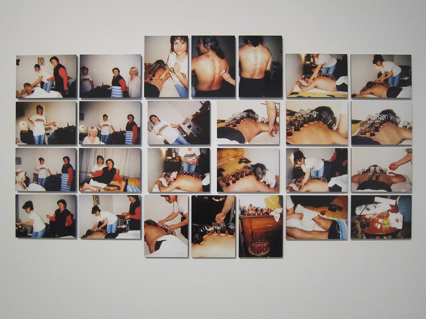 Hüseyin Bahri Alptekin, "Kan Çekme İyileştirme" (2000)