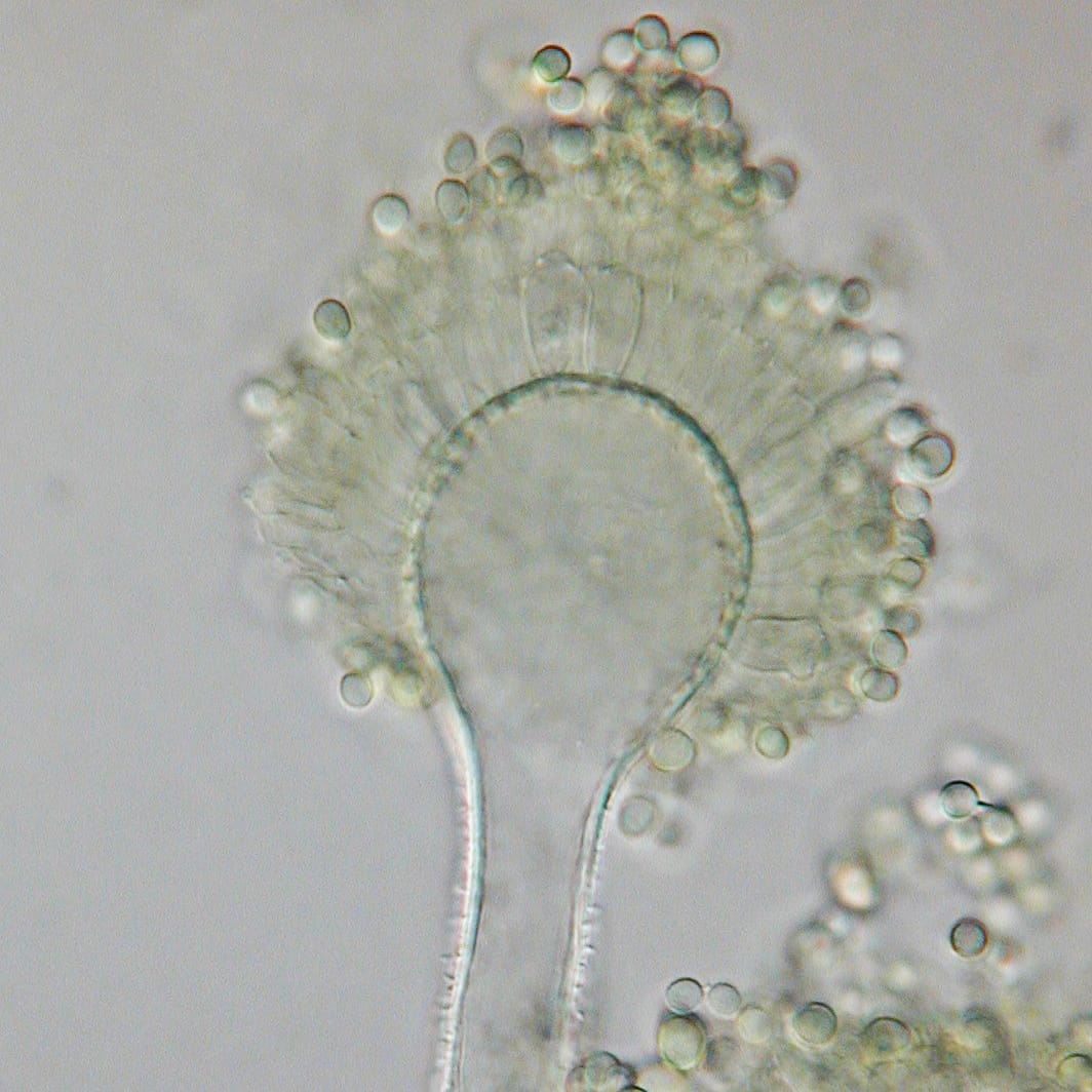 Aspergillus flavus, one of the molds that produces aflatoxins (photo by Medmyco/Wikimedia)