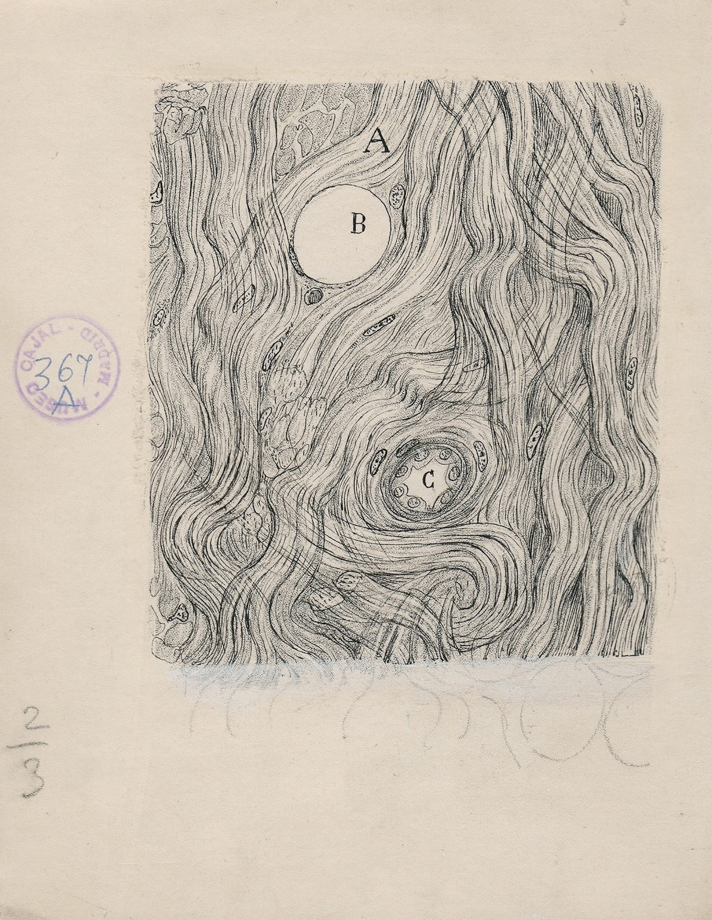 Santiago Ramón y Cajal, "Tumor cells of the covering membranes of the brain" (1890), ink and pencil on paper, 6 1/4 x 5 inches (Cajal Institute (CSIC), Madrid)
