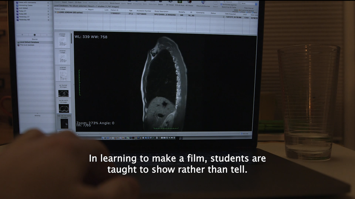 The inside of a body, including a spine and other organs, appears on a laptop screen. A hand reaches toward the laptop's keyboard. On top of the hand, a caption reads: "In learning to make a film, students are taught to show rather than tell."