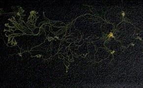 Two Beings Collaborate on Art, One a Human, Another a Slime Mold