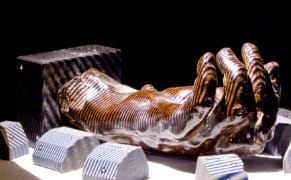 Diagnosing Rodin's Grotesque Hands