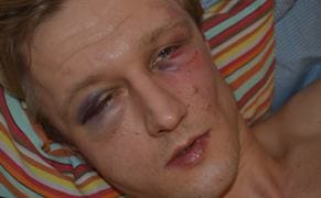 Curator Assaulted by "Paramilitary Thugs" in Kiev