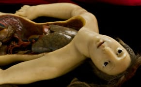 Centuries of Collecting the Curious and Macabre through Digital Storytelling