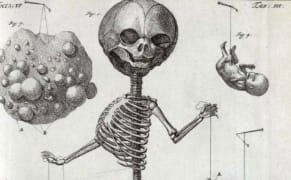 The 18th-Century Anatomist Who Celebrated Life with Dioramas of Death