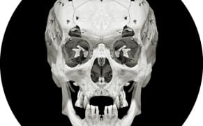 Creating a Skeletal Symmetry from a 19th-Century Collection of Imperfect Skulls