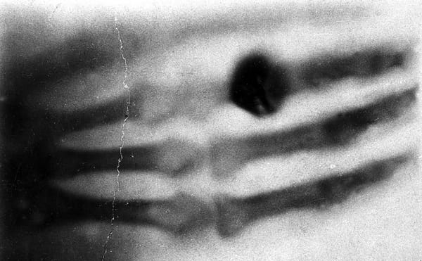 "I Have Seen My Death": The First X-Ray Photograph
