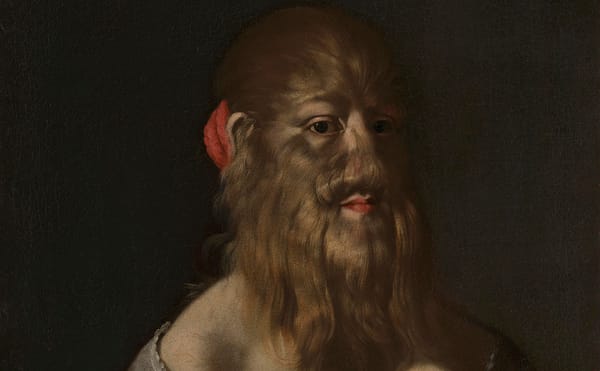The Wellcome Collection Acquires a Dignified Portrait of a 17th-Century Bearded Woman