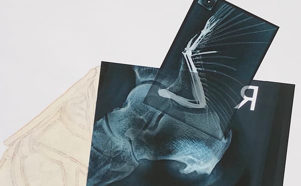 Where Angels Fear to Tread