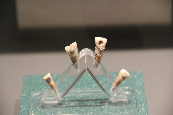 The Very Expensive Dental Work of the Ancient Maya