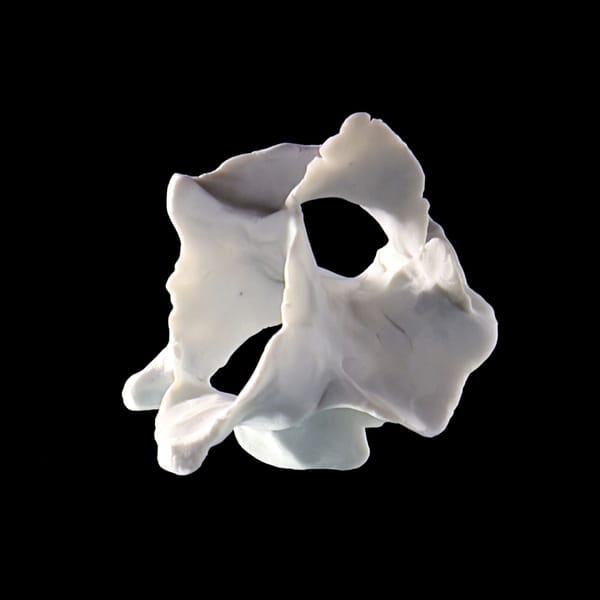 A Body of Work Inspired by One Hip Replacement